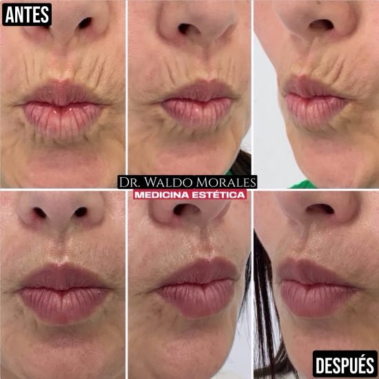 imgi_1_435725649_429464919679415_3262468155842315896_n