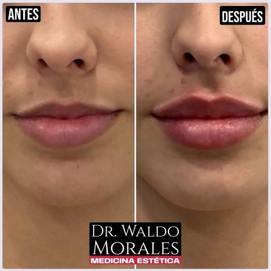 imgi_1_435785785_437132855538183_4212377644634316462_n