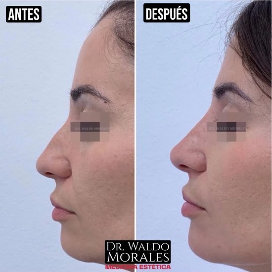 imgi_2_433788205_7240315629415722_1642866572741144586_n